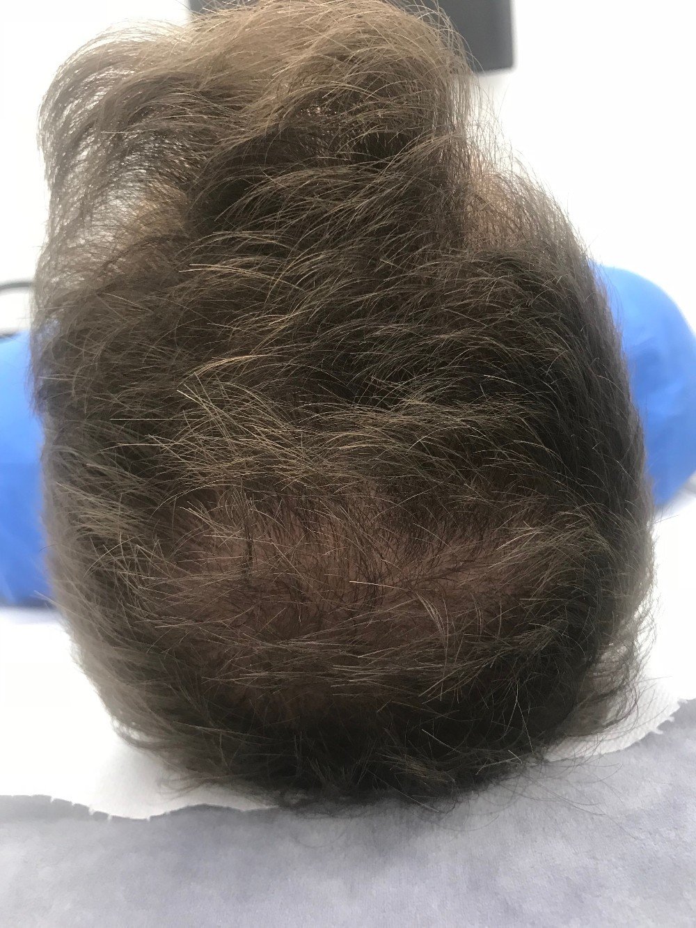 Porost włosów Dr Cyj Hair Filler terapia Beauty Address